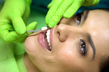 dentist placing veneers on woman
