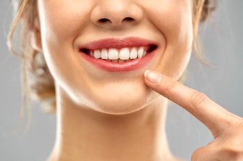 woman pointing to her teeth