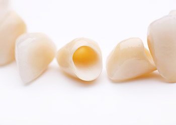 Tooth-colored dental crowns prior to placement