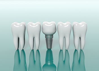 Model dental implant in Cumberland next to model teeth