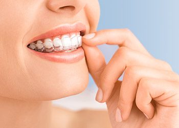 Closeup of woman placing Invisalign tray