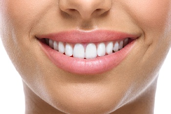 Close-up of beautiful smile after treatment with soft tissue laser