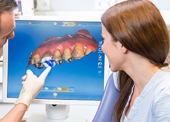 CEREC bite impressions on computer