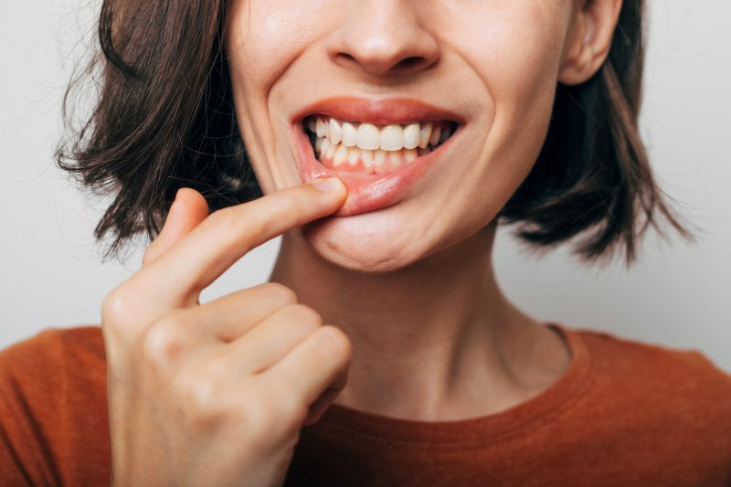 Woman shows inflamed gums